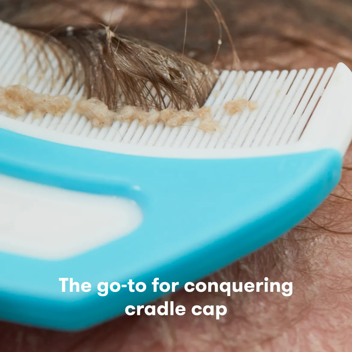 DermaFrida The FlakeFixer The 3-Step Cradle Cap System